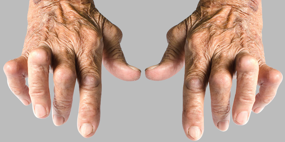 arthritis-homeopathy-treatment-panvel