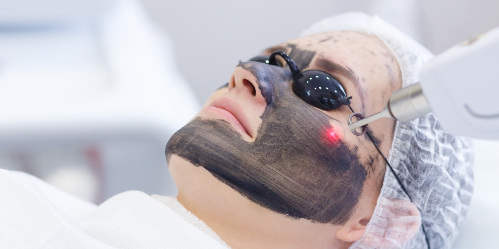 carbon-facial-treatment-panvel