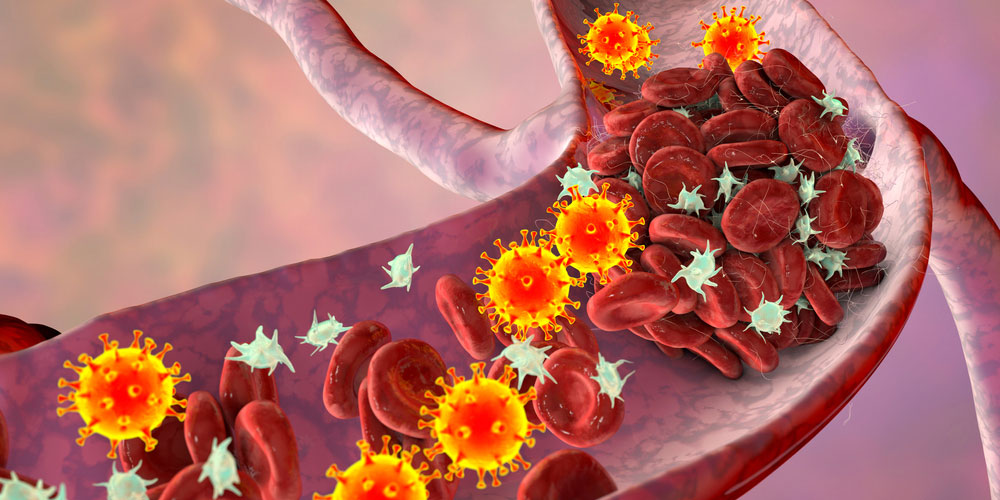 covid-19-virus-homeopathy-treatment-panvel