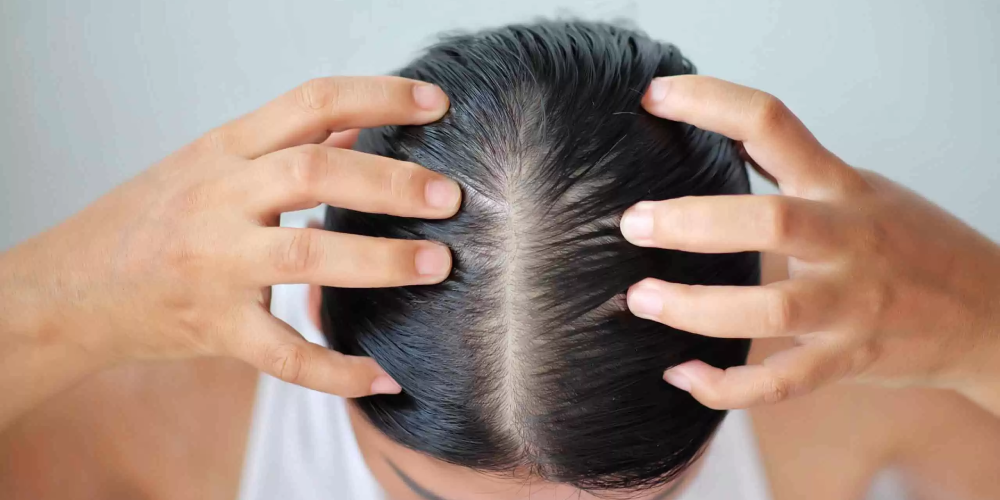 the-health-problems-of-bad-hair-homeopathy-treatment-panvel