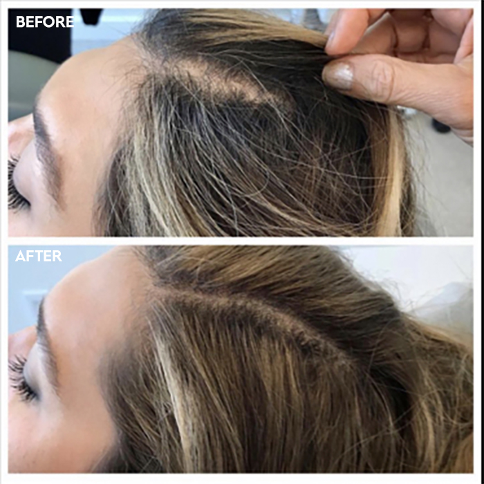 images-1-hair-prp-dr-tushar-ratnakar